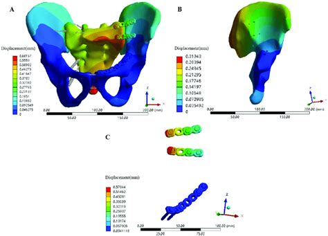 Displacement Distribution Of Each Component Of The Pelvis Model Fixed Download Scientific