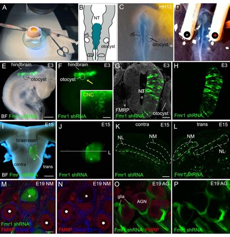 Dissecting Cell Autonomous Function Of Fragile X Mental Retardation