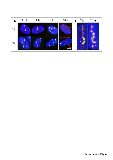 Structures of γH2AX 53BP1 foci streaks and their dynamic changes with