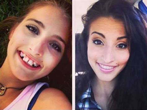 Holky Na Sex Na Hotel