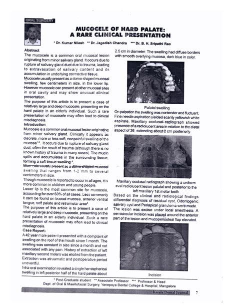 Pdf Mucocele Of Hard Palate A Rare Clinical Presentation