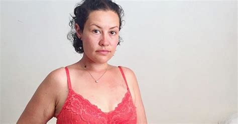 Disabled Person Inspiration Porn Response Body Image