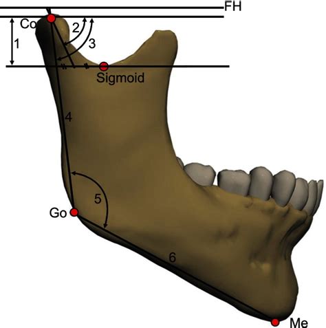 Lateral View Of The Mandible Shows Ramal And Condylar Landmarks And Download Scientific Diagram