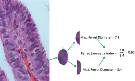 Peziza Under Microscope Labeled