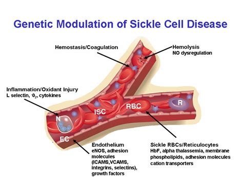 Research Center Of Excellence In Sickle Cell Disease Boston University