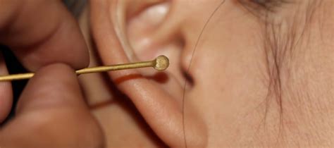 The Best Ear Wax Removal | Reviews, Ratings, Comparisons