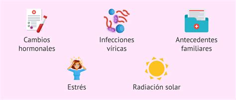 Agentes Desencadenantes Del Lupus