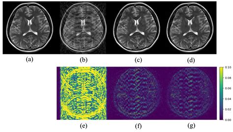 Sensors Free Full Text Reference Driven Compressed Sensing Mr Image