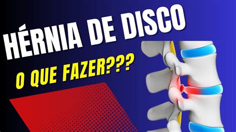 Hérnia de Disco O que fazer YouTube