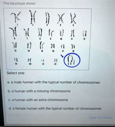 Solved This Karyotype Shows Select One A A Male Human With The