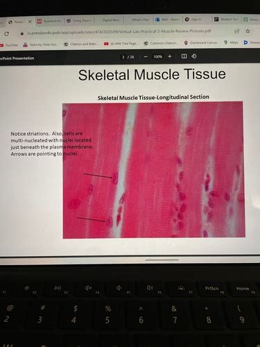 Muscles Lab Practical Flashcards Quizlet