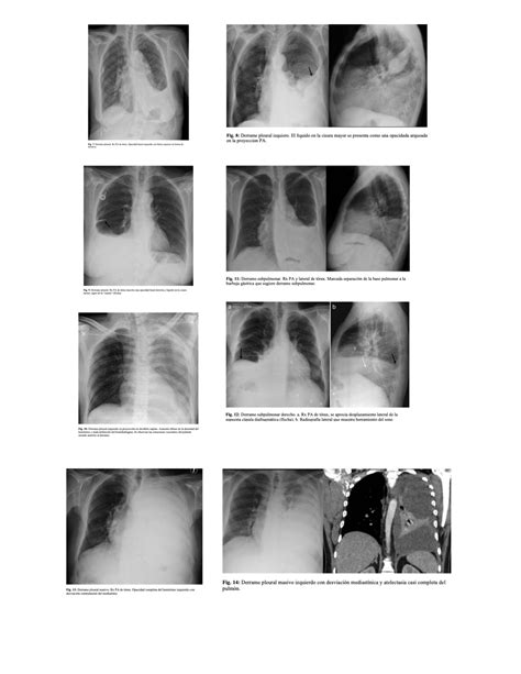 Signos Radiol Gicos Torax Radiolog A Studocu