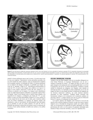 Corazon Fetal Isuog Pdf