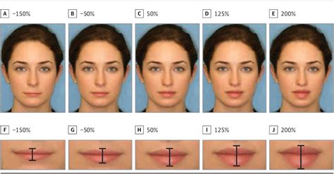 A Quantitative Approach To Determining The Ideal Female Lip Aesthetic