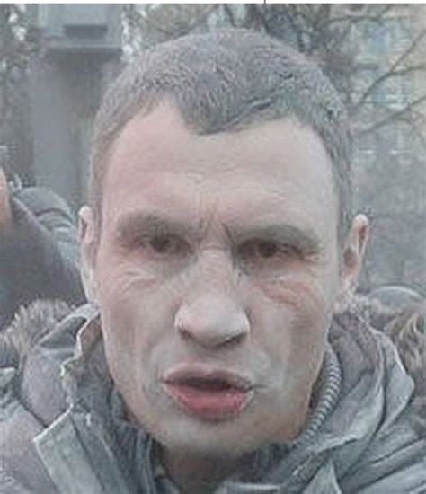 Нелетальное ядерное оружие
