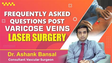 Frequently Asked Questions Post Varicose Veins Laser Surgery Dr