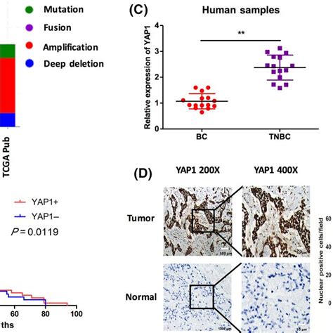 Yesassociated Protein 1 YAP1 Expression In Triplenegative Breast