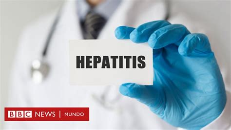 Hepatitis Qué Tipos Hay Y Cómo Diferenciarlos Bbc News Mundo