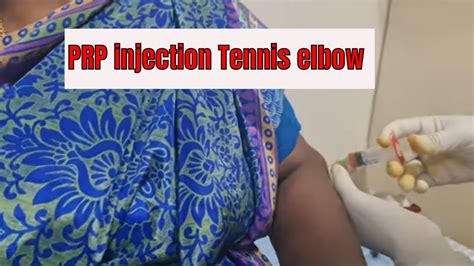 Tennis Elbow Treatment Chennai PRP Injection Live YouTube