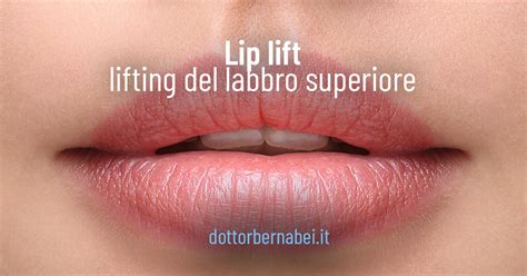 Lip Lift Dr Gianfranco Bernabei Chirurgo Plastico A Milano