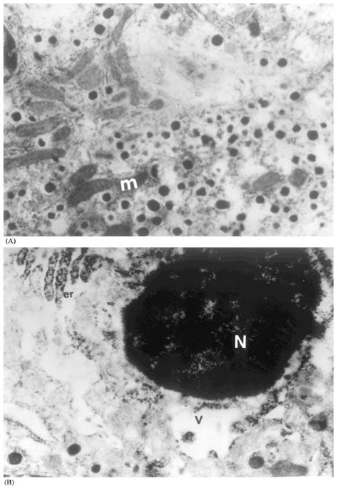 A Electron Photomicrograph Of A Normal Control Rat Pancreas