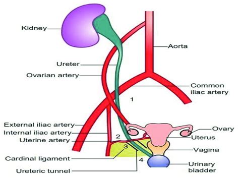 Cardinal Ligament Ureter