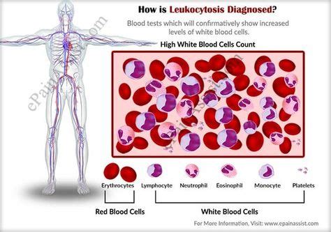 Leukocytosis