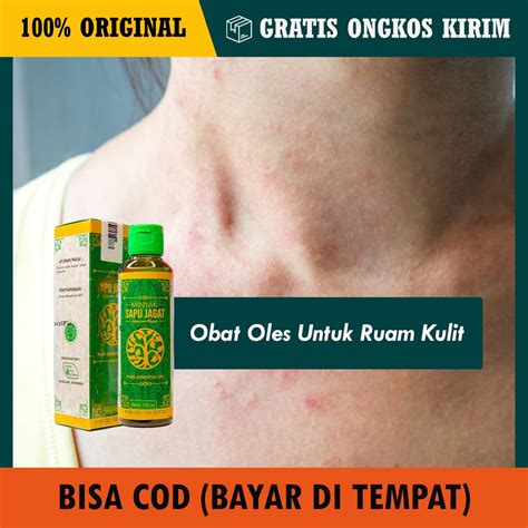 Obat Ruam Kulit Homecare24