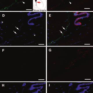 Fibroblast Growth Factor Fgf Binding To Fractones Depends On