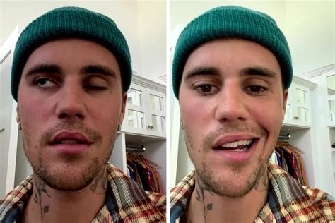 Justin Bieber Sad Face