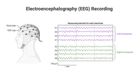 Electroencephalography Eeg Recording Biorender Science Templates