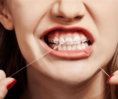 Here Are 6 Common Dental Hygiene Mistakes To Avoid