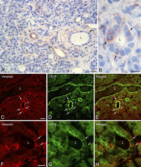 Expression Of Vimentin In Ductal Cells Of Normal Human Pancreas A B