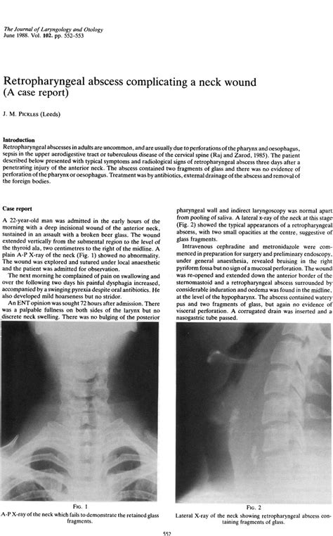 Retropharyngeal Abscess Complicating A Neck Wound The Journal Of Laryngology And Otology