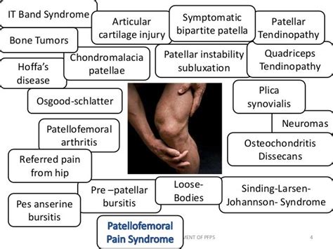 Patellofemoral Pain Syndrome Pfps