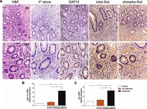 Immunohistochemical Detection Of DAP12 And Syk In Human CD A