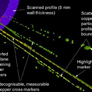 Maximum Intensity 3D Projection Of CT Data For End Section Of Profile 2