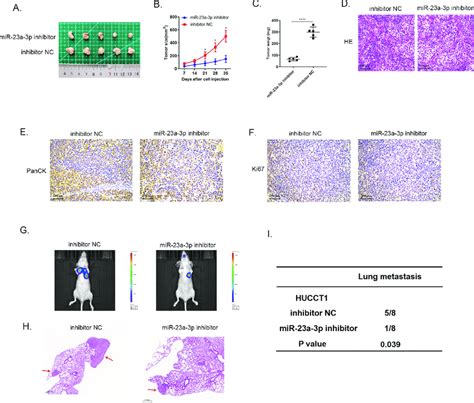 Decreasing Mir A P Expression Could Inhibit Growth As Well As