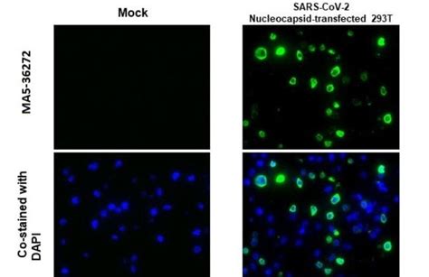 SARS CoV 2 Nucleocapsid Monoclonal Antibody HL453 Invitrogen 100 μL