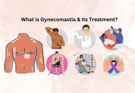 gynecomastia   treatment happiness creativity