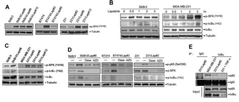 Sfk Activation Contributes To Induction Of Nf κb By Lapatinib A