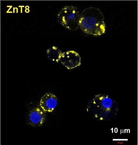 mAb43 (yellow) in beta cells [IMAGE] | EurekAlert! Science News Releases