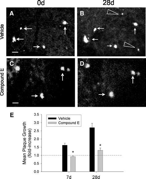 Characterizing The Appearance And Growth Of Amyloid Plaques In App Ps1