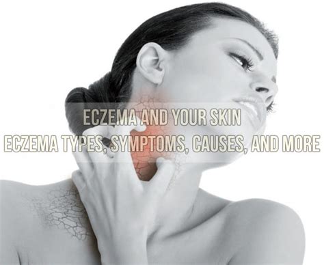 Eczema And Your Skin Eczema Types Symptoms Causes And More Skin Care