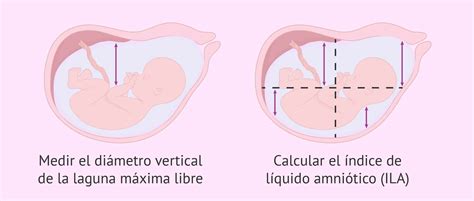 Qu M Todos Existen Para Medir El Desarrollo Fetal Mibbmemima