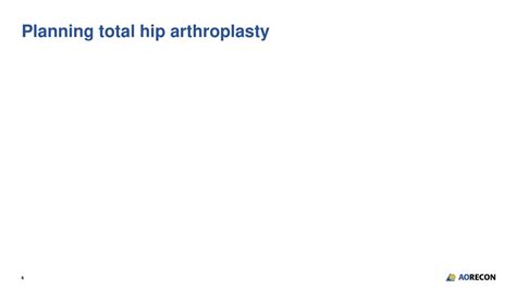 Step By Step Guide Planning Total Hip Arthroplasty Ppt Download