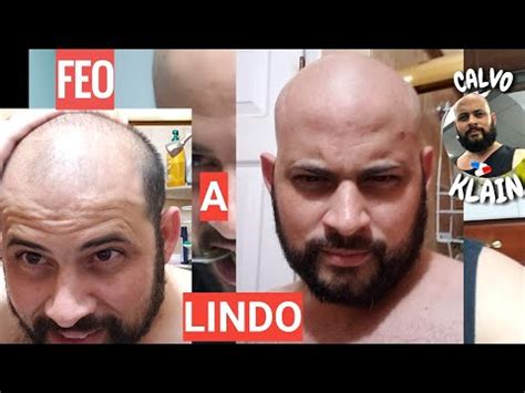 Cortes De Pelo Para Hombre Calvo Tienda Madre Tierra