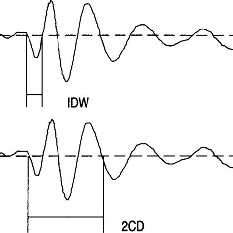 The Morphology Of One Crackle In Time Expanded Waveform Display In