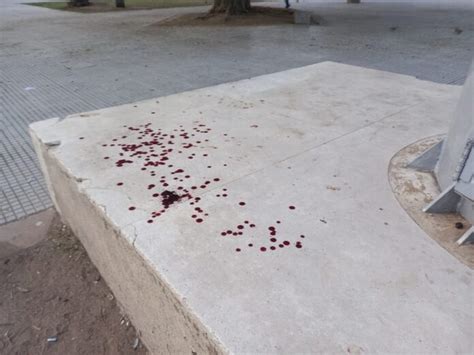 Perdió dos dedos de una mano izando la bandera en Plaza 25 de Mayo