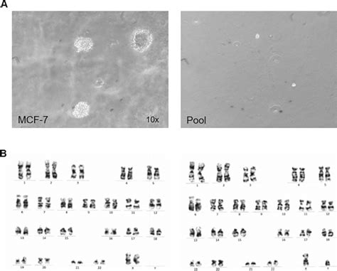 Soft Agar Assay And Karyotyping A Representative Phase Contrast Images Download Scientific